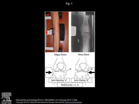 D Kumar K T Manal K S Rudolph Osteoarthritis And Cartilage Ppt