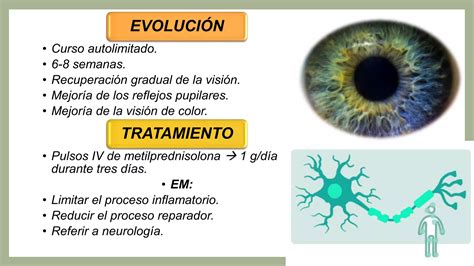 El Nervio Optico Y Sus Alteraciones Ppt