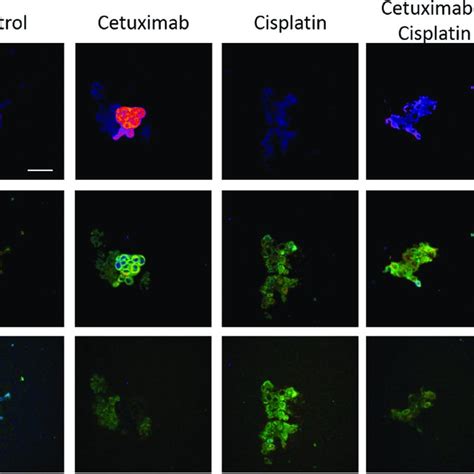 Autofluorescence Images Show The Redox Ratio And Fluorescence Lifetimes