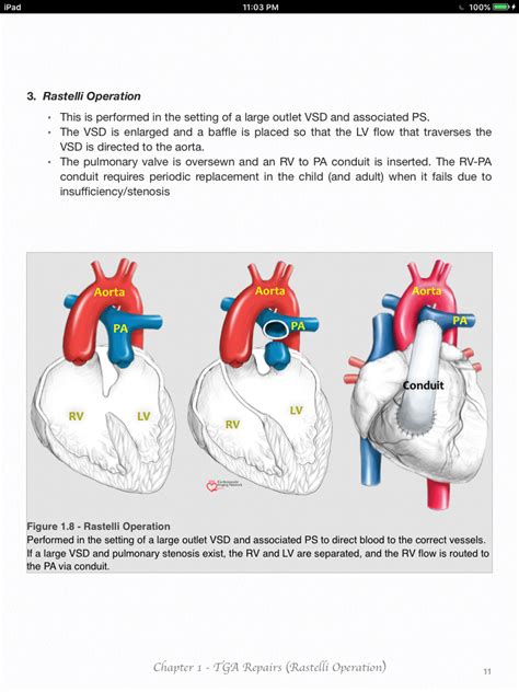 Pin on Cardiac