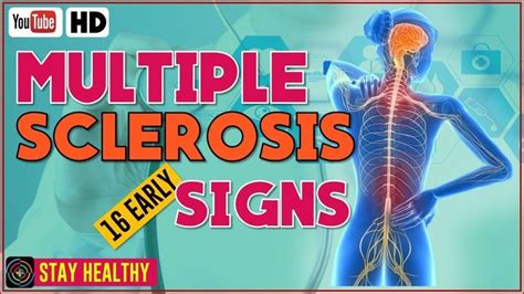 Early Signs And Symptoms Of Multiple Sclerosis You Should Know