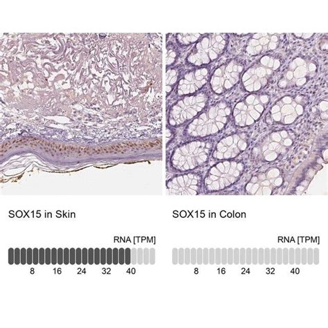 Anti SOX15 Antibody Produced In Rabbit