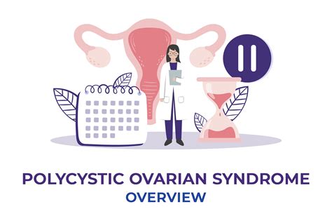 Polycystic Ovarian Syndrome Overview Mediq