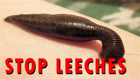 How To Stop Leeches Youtube