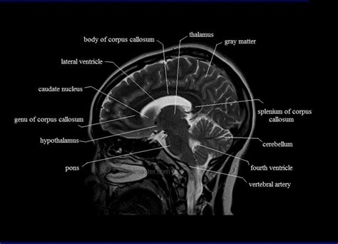 Mri Sagittal Cross Sectional Anatomy Of Brain Image 13 Fisiología