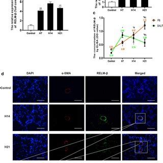 Expression Pattern Of Relm In Tissues From An Hph Rat Model Wb