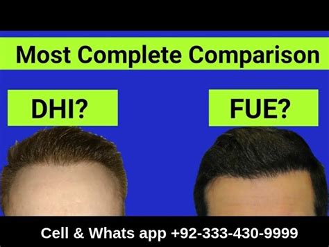 DHI VS FUE Technique Hair Transplant Technique Fue Hair Clinic Pakistan