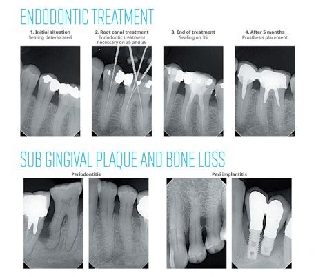 De Gotzen Xmind Unity Dc Periapical Radiography Unit Mobile Dandal