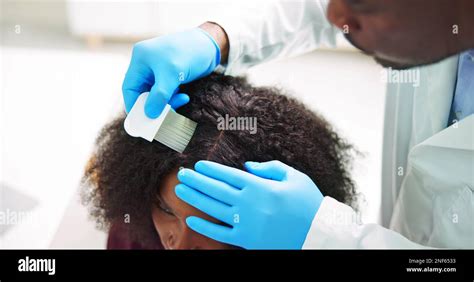 Scalp Treatment From Psoriasis And Dandruff Dermatologist Doctor Stock