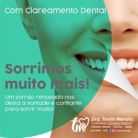 Clareamento Dental Sorrimos Muito Mais Um Sorriso Renovado Nos