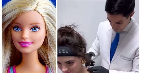 Botox Da Barbie Entenda Os Riscos Da Busca Pelo Pescoço Da Boneca