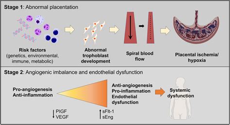 Two Staged Model Of Preeclampsia Pathogenesis Stage Consists Of The