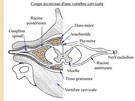 Les Compressions Medullaires Lentes Ppt T L Charger