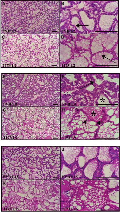 Increased Size Of Lipid Droplets In Mammary Glands From Myr Akt