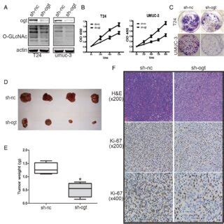 Reduction Of Ogt Promoted Bladder Cancer Cell Apoptosis And Inhibited