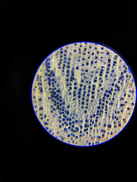 Allium (onion) root tip L.S. Under Microscope - Biology Notes Online