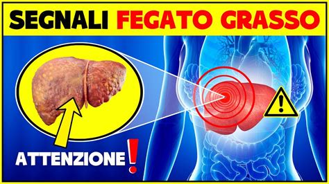 Sintomi Fegato Grasso Attenzione Ai Segnali Che Il Fegato Ti Manda