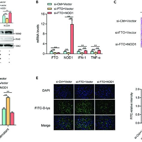 FTO Mediated M 6 A Demethylation Of NOD1 MRNA Affects Its Stability And