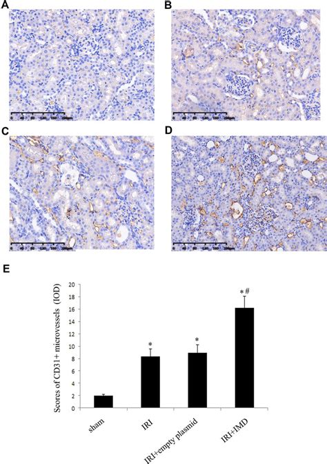 Evaluation Of CD31 Labelled Microvessel Density In Kidneys A D