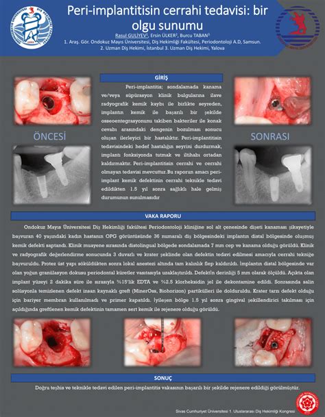 Pdf Surgical Treatment Of Peri Implantitis A Case Report