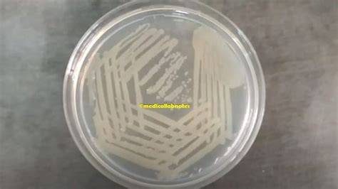 Nutrient Agar Introduction Composition Test Requirements For Preparation Test Procedure