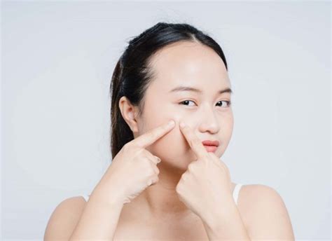 4 Perbedaan Chemical Dan Physical Sunscreen