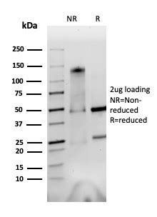 Integrin Alpha V Beta Antibody Clone Avb A Gene Id