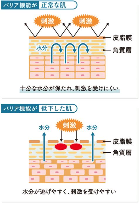 冬の乾燥から肌を守ろう 湧永製薬株式会社