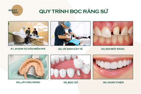 Quy trình bọc răng sứ bao gồm các bước nào Nha khoa Westway