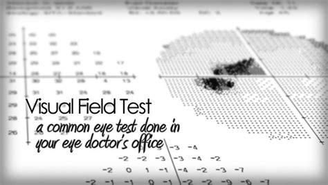 Visual field test for checking side vision