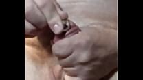 year cm dick meatotomy subincisión circuncisión y masturbación XVIDEOS