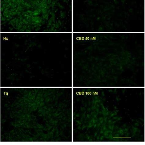 Hypoxia Effect On Glial Mixed Culture Representative Phase Contrast