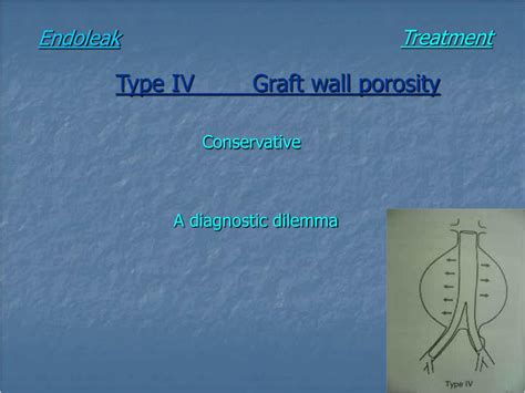 PPT - Endoleak PowerPoint Presentation, free download - ID:4090468