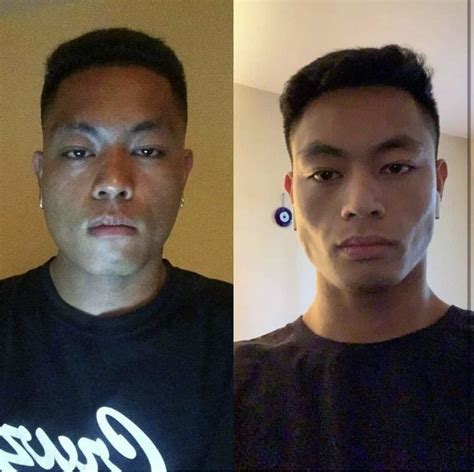 3 Effective Transformation Mewing Before And After Chiseled Jawline