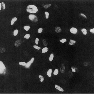 A Phase Contrast Micrograph Of Juvenile Human Costal Chondrocytes