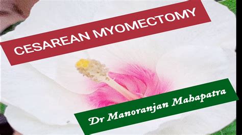 Cesarean Myomectomy Masterclass Caesarean Section Myomectomy