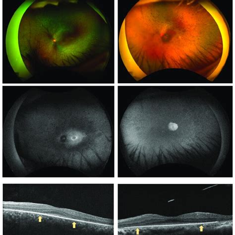 Color Fundus Photography Fundus Autofluorescence Faf And Optic