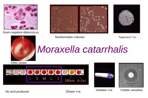 Moraxella catarrhalis: Properties, Lab Diagnosis • Microbe Online