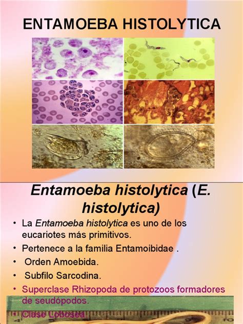 Entamoeba Histolytica Microbiology Diseases And Disorders