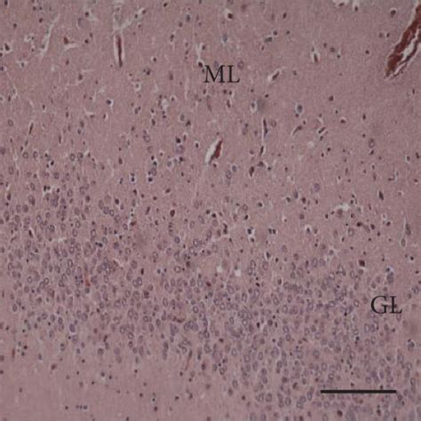 Hippocampal Dentate Gyrus From Controls And Patients With Tle And