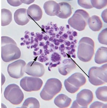 Types Of Leukocytes Flashcards Quizlet