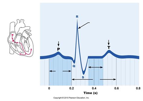 Chapter 18 Ecg Diagram Quizlet