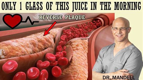 Only A Glass Of This Juice Will Help You Unclog Arteries