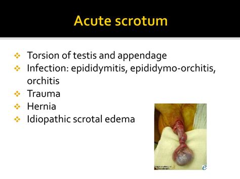 Ppt Approach To Common Pediatric Surgical Problems Powerpoint