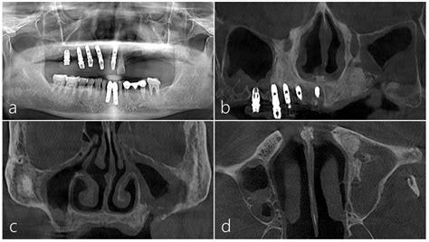 Medicina Free Full Text A Novel Approach For The Treatment Of