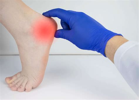 Fascitis Plantar Phoenix Az Valley Foot Care Inc