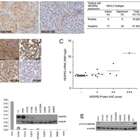 Vegfr2 Protein Is Expressed In Nsclc Tumours And Tumour Cell Lines A Download Scientific