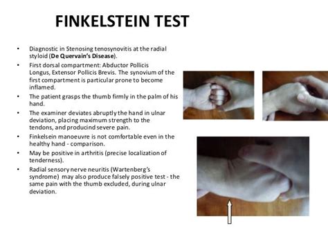 Finkelstein Test Finkelsteins Test Youtube The Eichhoffs Test