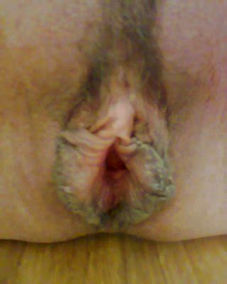 Big Labia Milf Porn Pics PICTOA