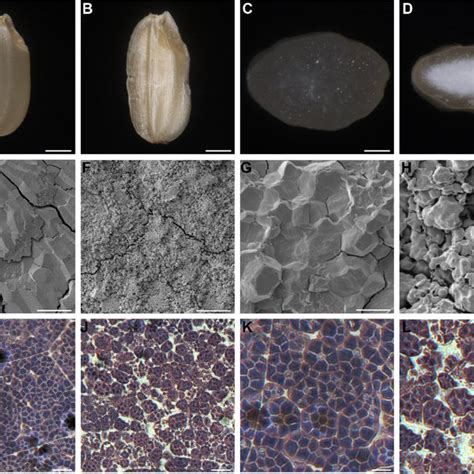 Phenotypes Of Mature And Developing Seeds Of The Wt And Fse5 Mutant A